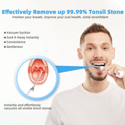 FreshThroat™ - Vacuum Tonsil Stone Extractor