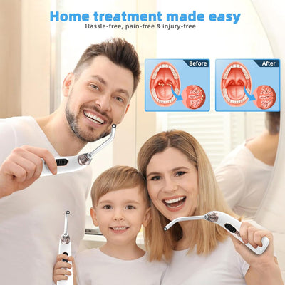 FreshThroat™ - Vacuum Tonsil Stone Extractor